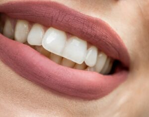 笑顔の美しい口元